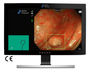 Ai for endoscopy image